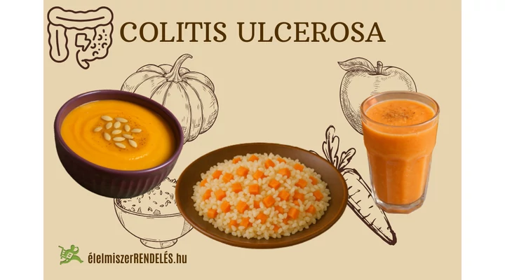 Colitis ulcerosa